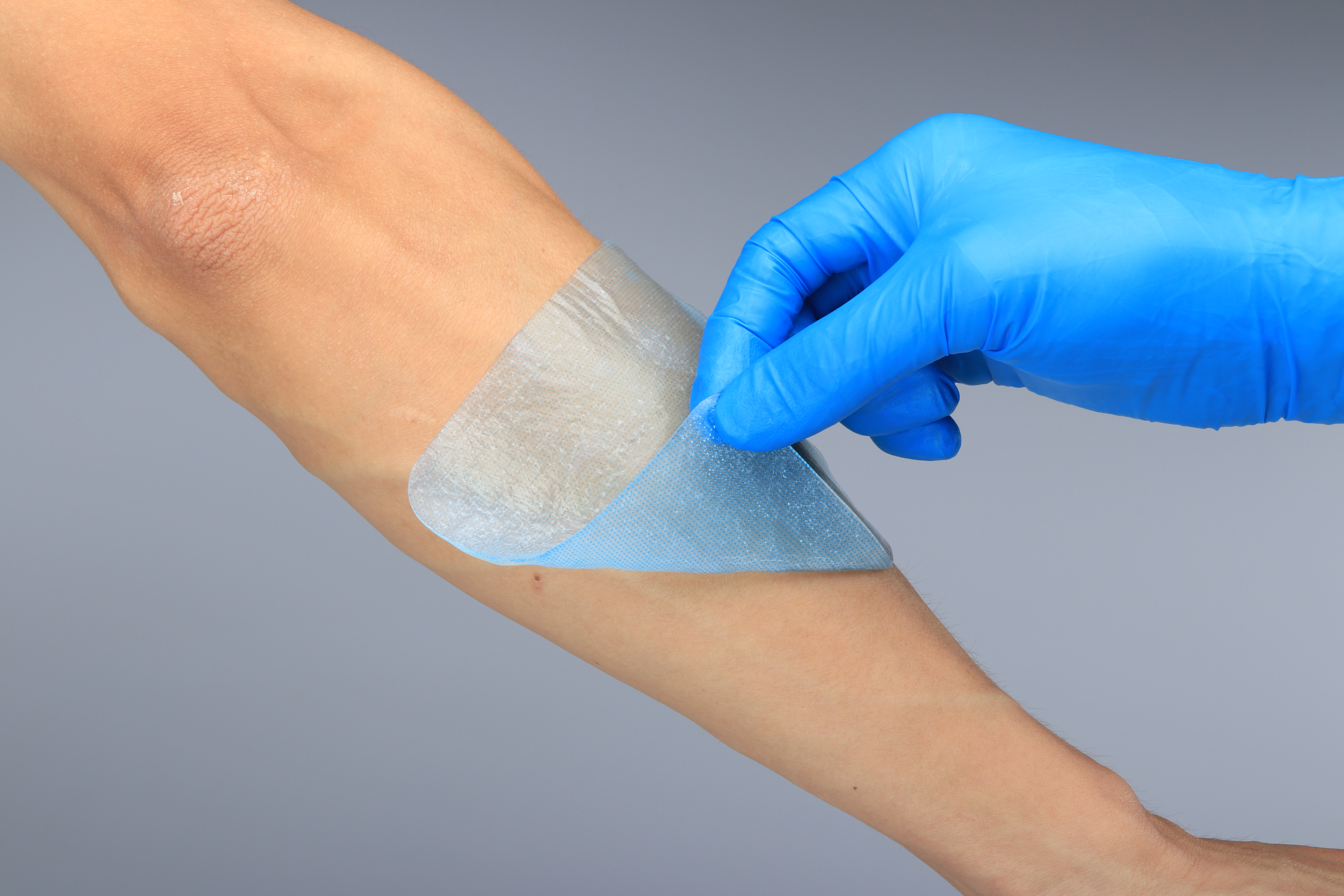 Behandeling van kleine brandwonden Absorberend steriel medisch hydrogelverband