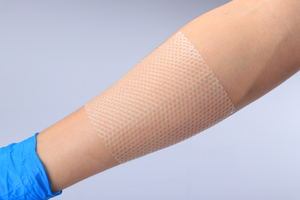 Huidbescherming FDA goedgekeurde Iso/Ce siliconen contactlaag