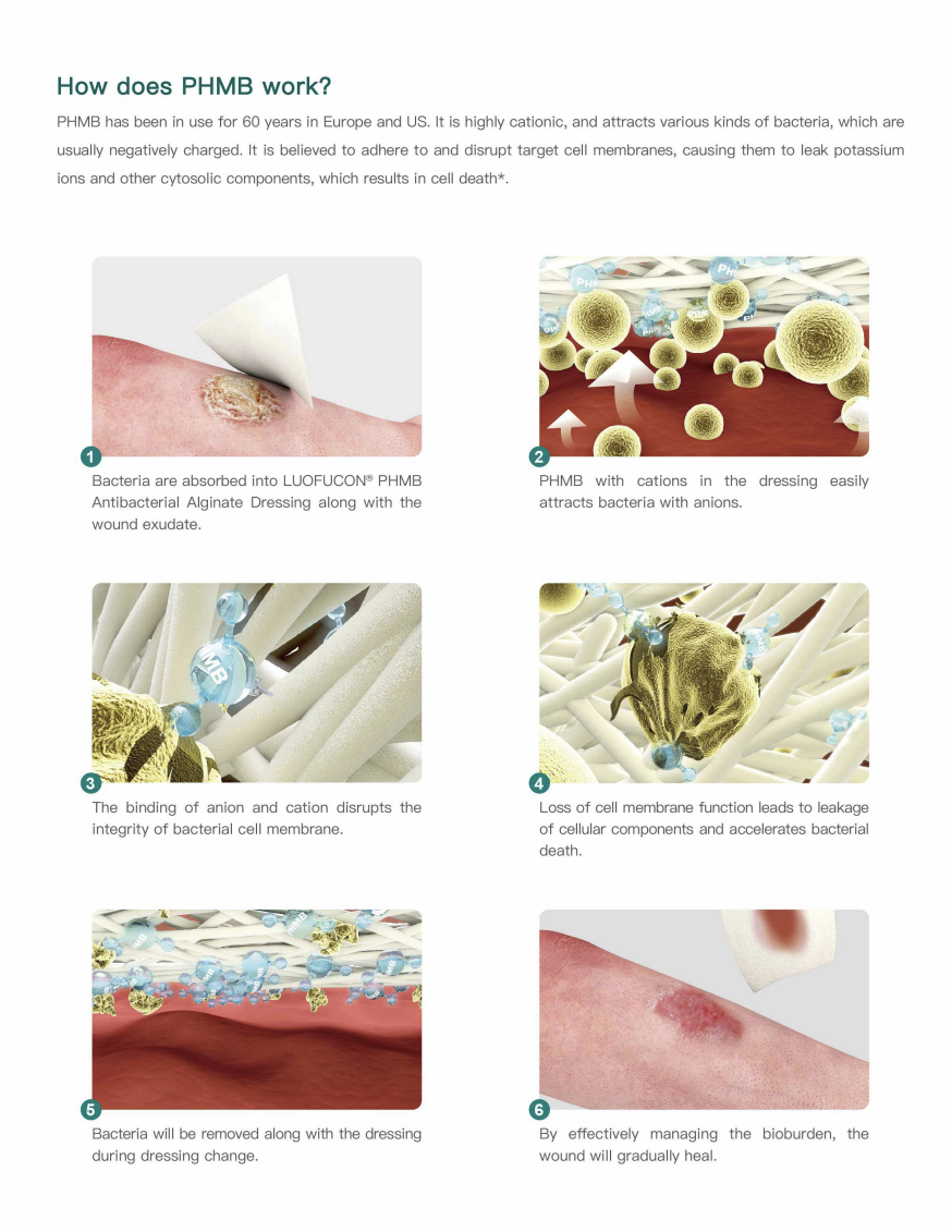 Steriel antibacterieel PHMB-alginaatverband met hoge absorptie voor hemostase