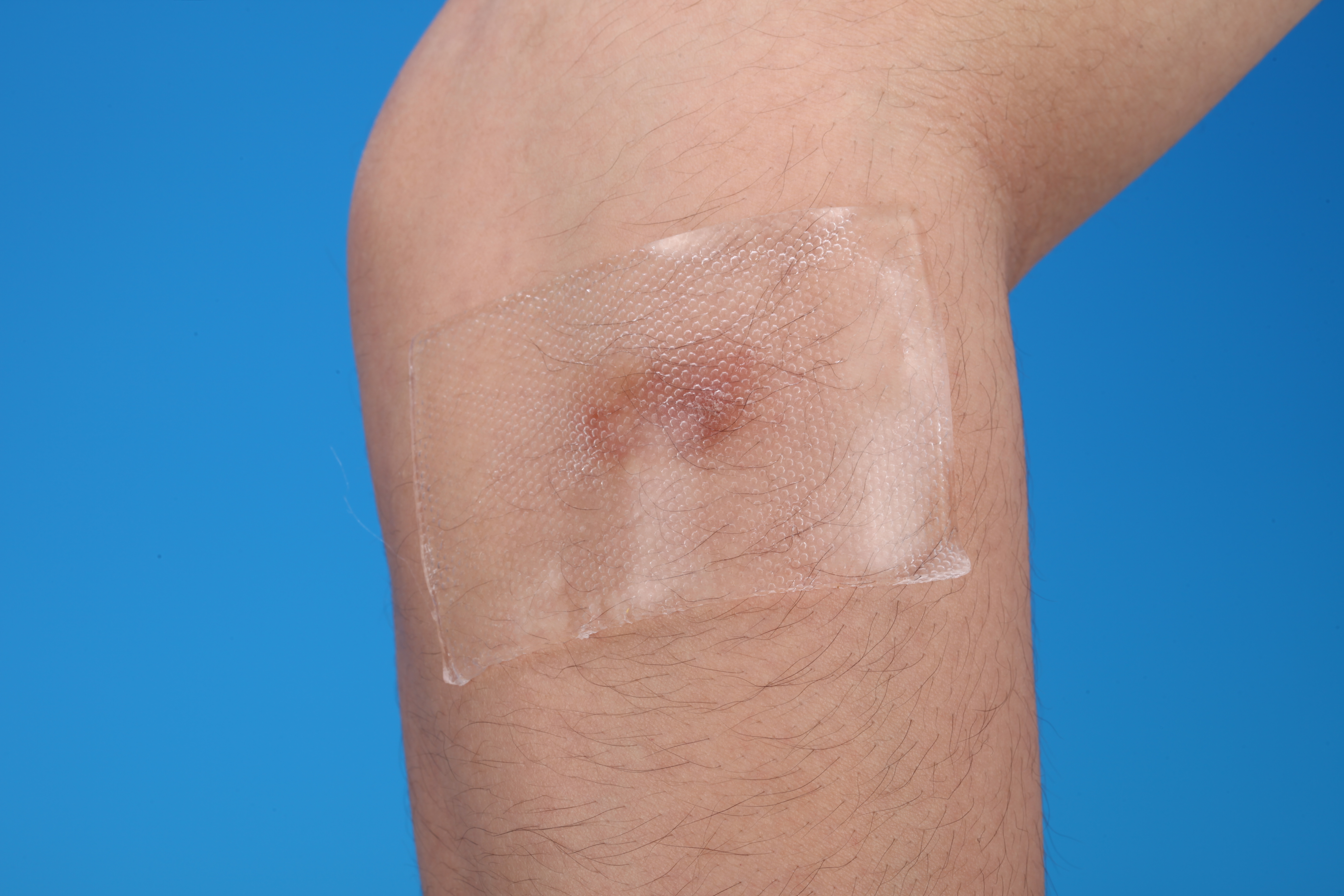 verwijdering litteken herhaal gebruik ISO/CE Silicone Scar Dressing