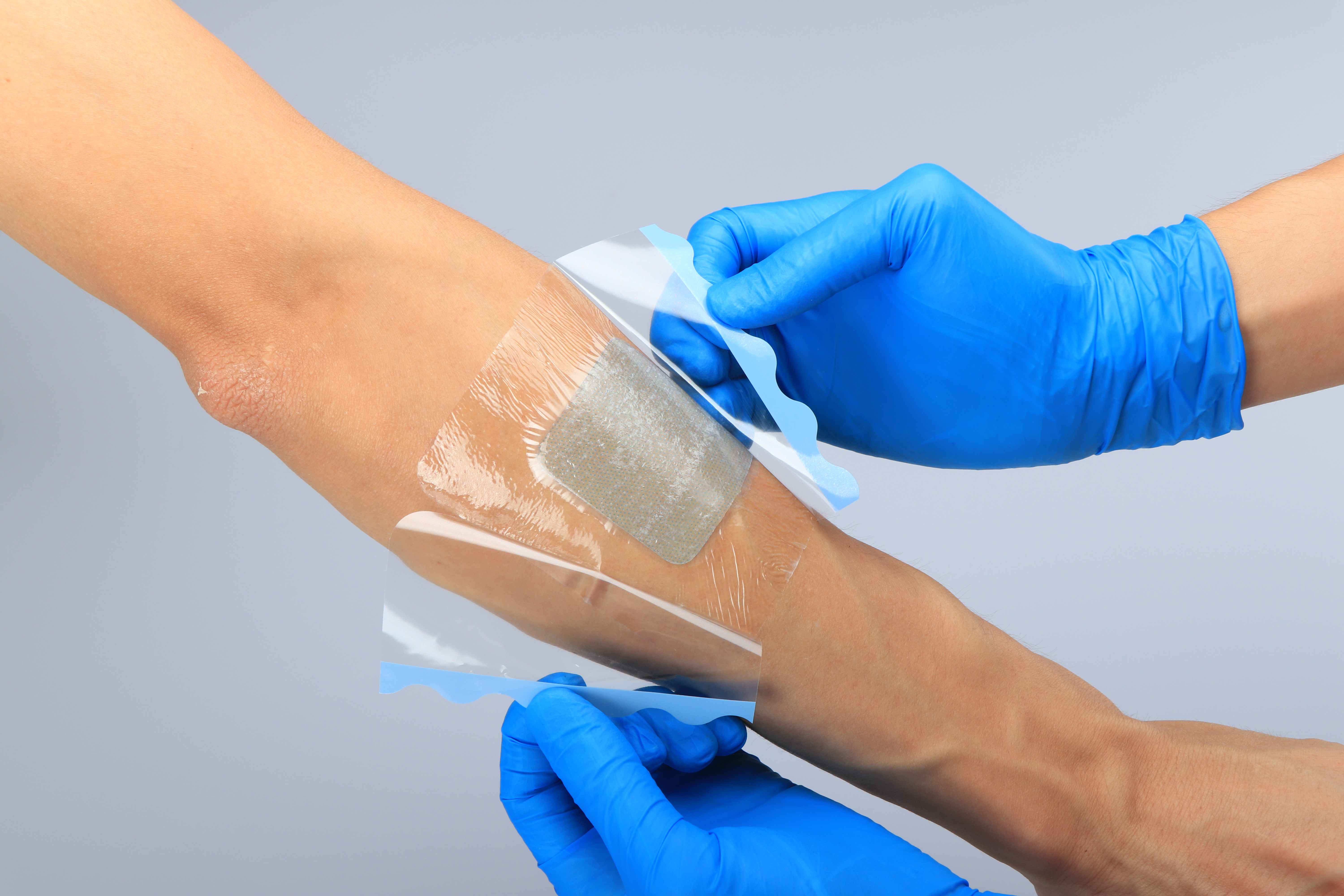 Decubitus Keto-vriendelijke medische hydrogelverband met lijm